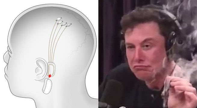 fot. Neuralink